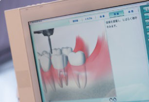 歯列矯正イメージ